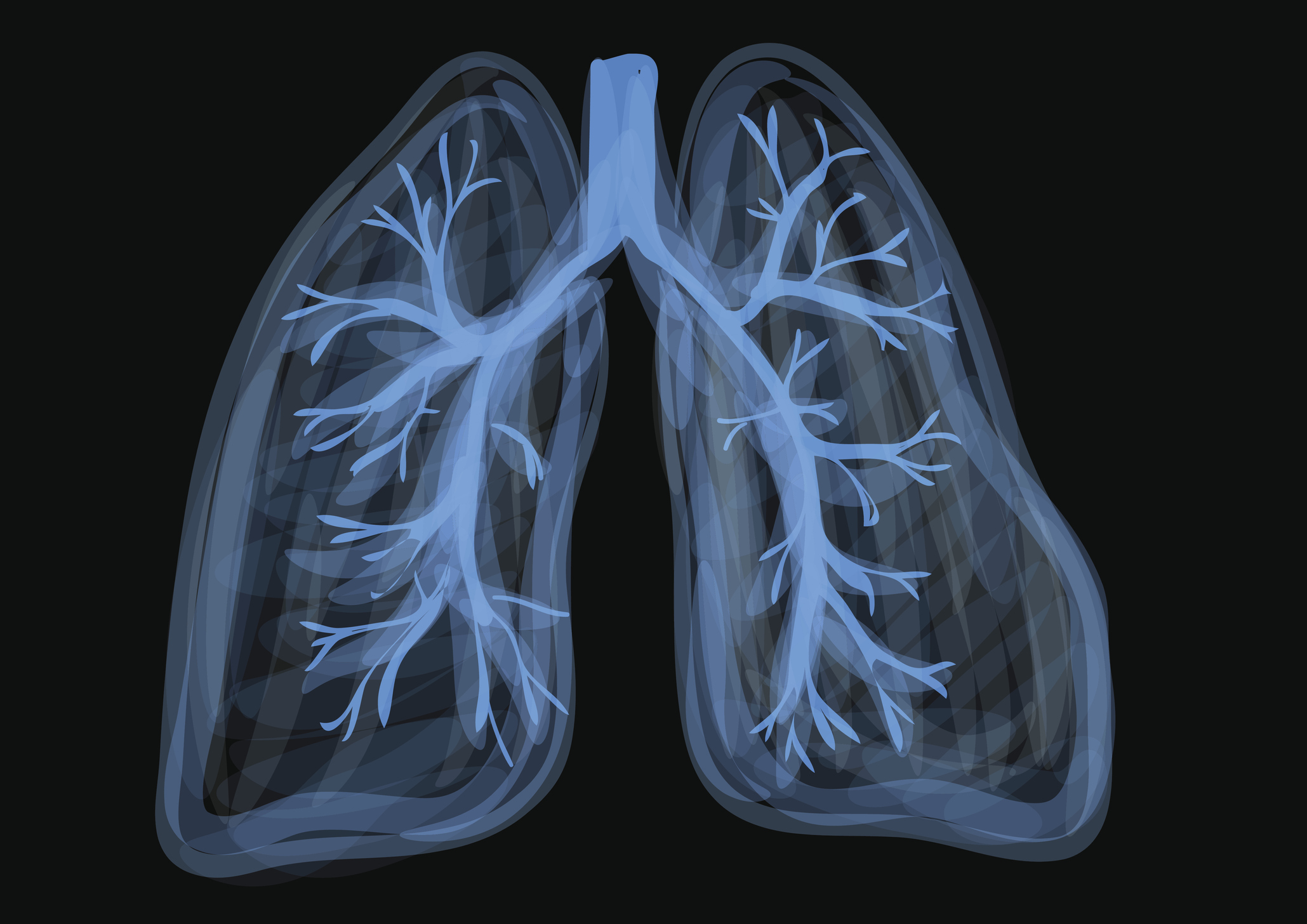 Illustration of lungs with vapor or smoke