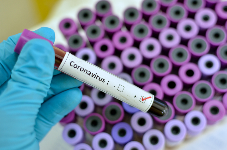 Coronavirus - World Health Organization